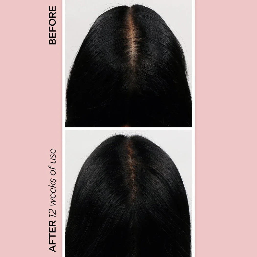 GlowHairTherapy™