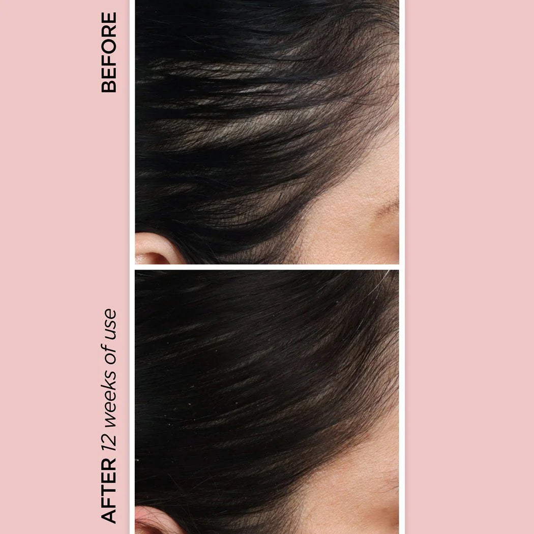 GlowHairTherapy™
