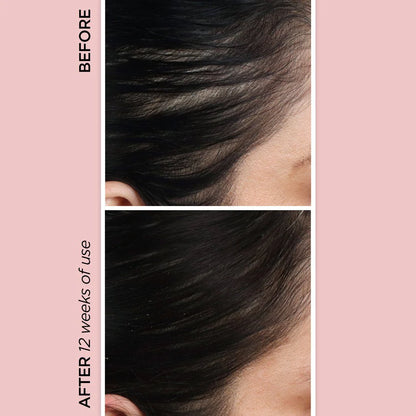 GlowHairTherapy™
